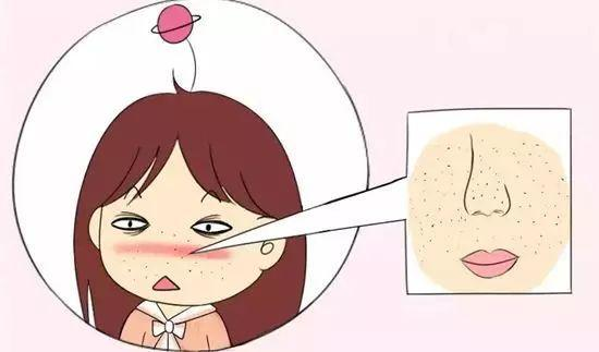 女生毛孔粗大到底應該怎么辦? 女生毛孔粗大到底應該怎么辦?