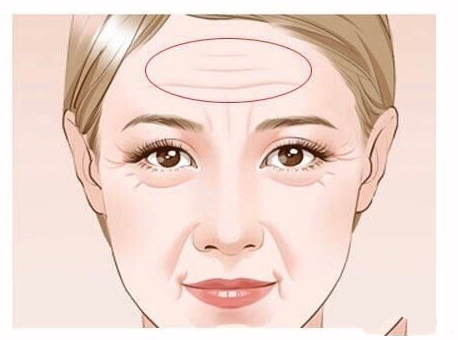 ?年紀輕輕?有了抬頭紋？